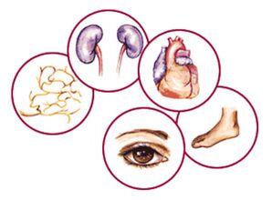 Organs to which complications of diabetes
